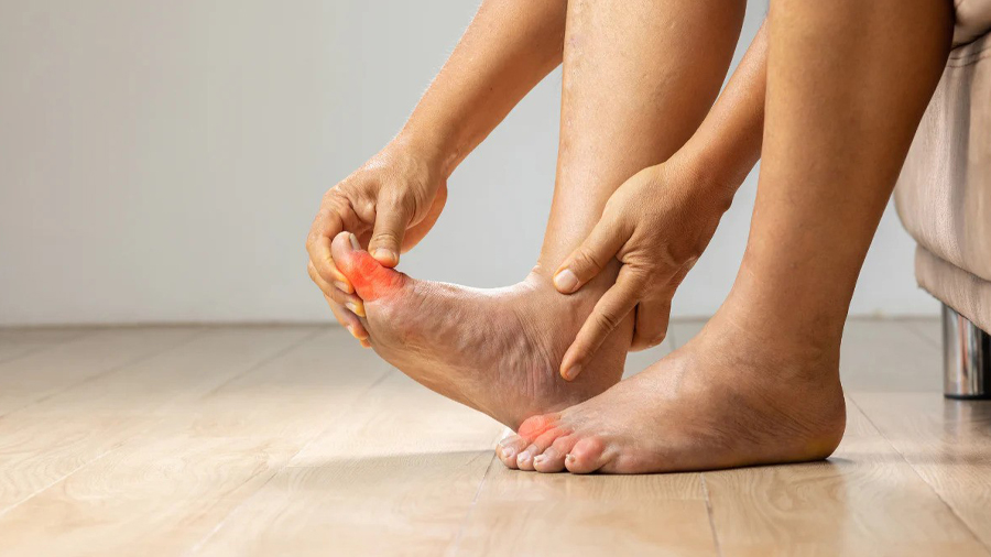 Homeopathy for Rheumatoid Arthritis & Gout: A Natural, Individualized Approach